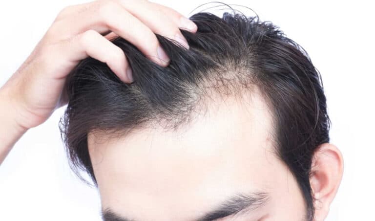 Top Hair Growth Products for Men
