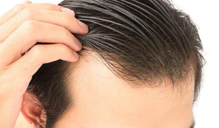 Top Hair Growth Products